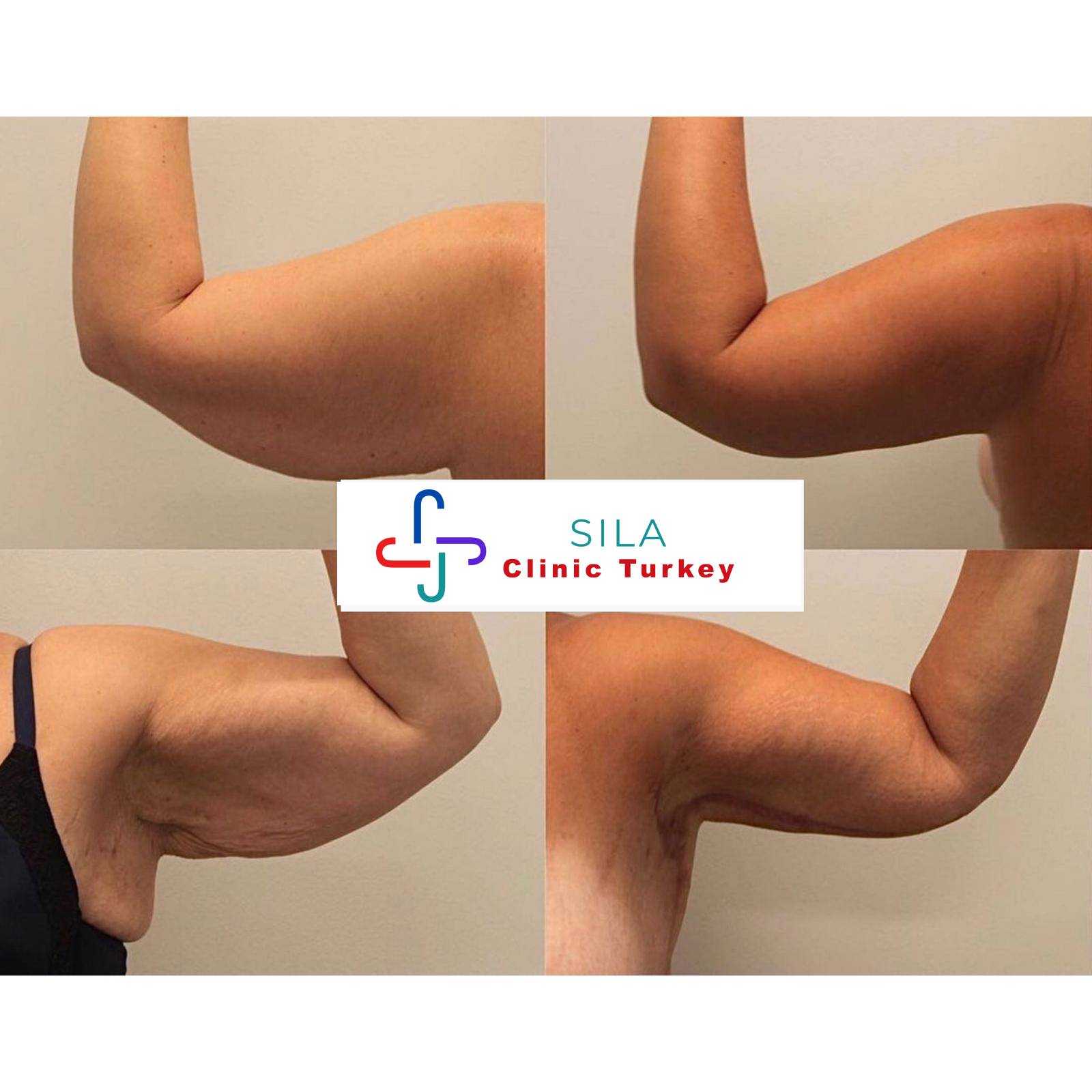 Kol Germe -  Image 1