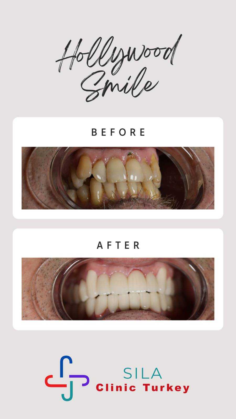 Kompozit Lamina Kaplama -  Image 2