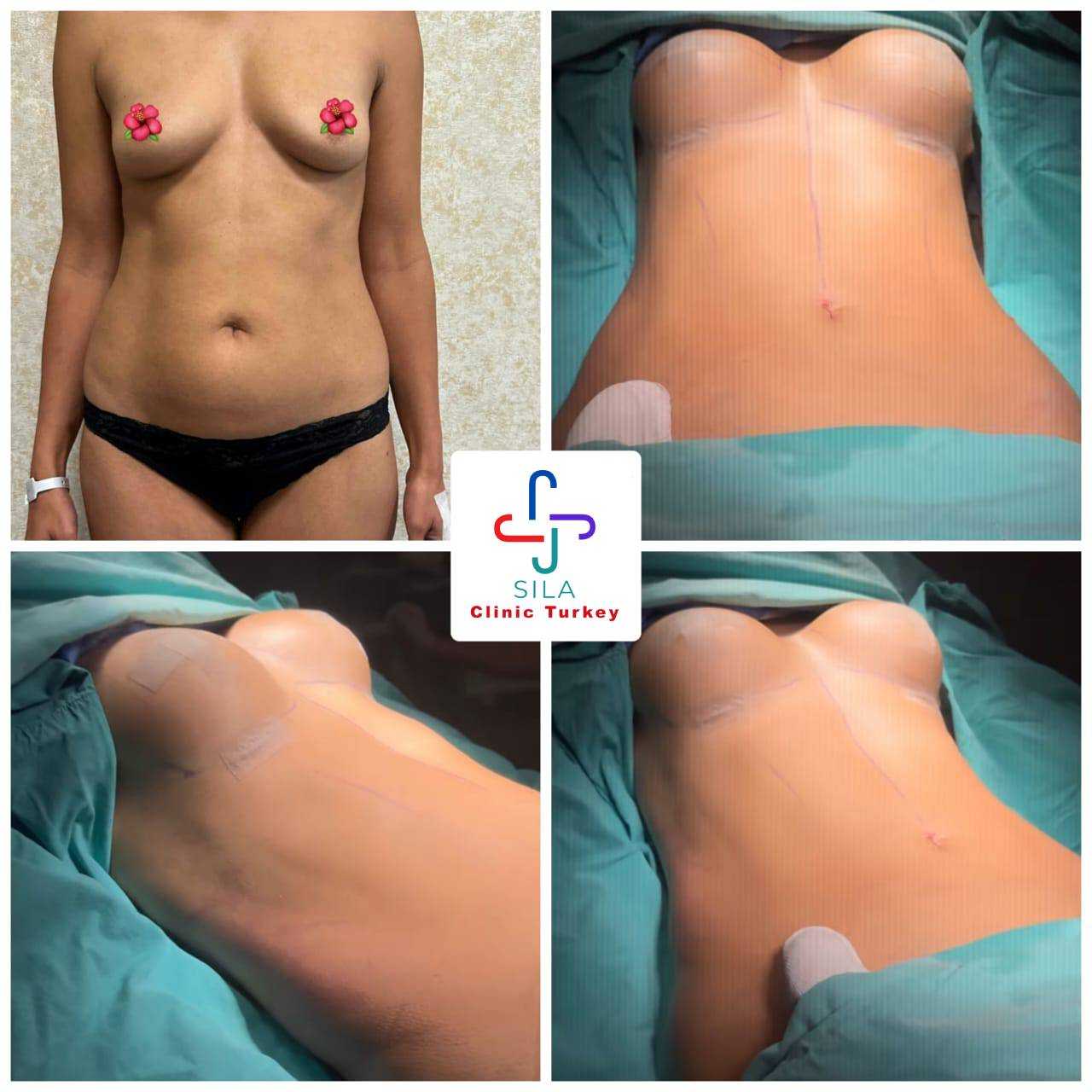 Meme Büyütme -  Image 1