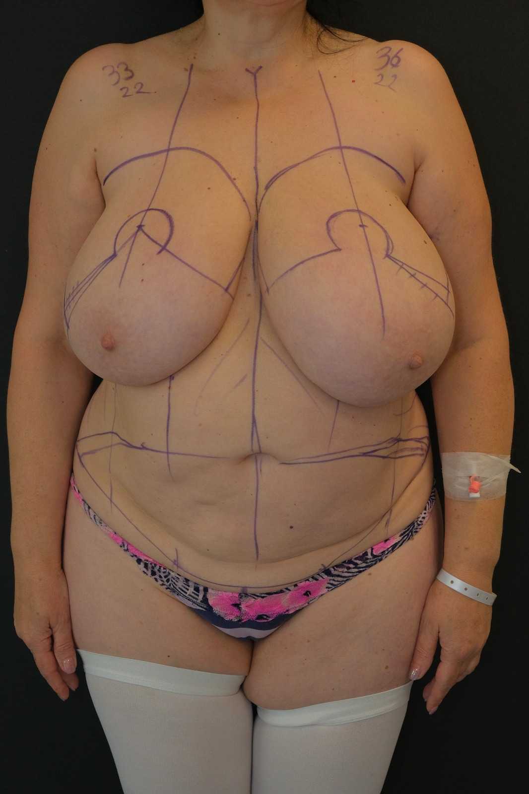 Meme Küçültme -  Image 3