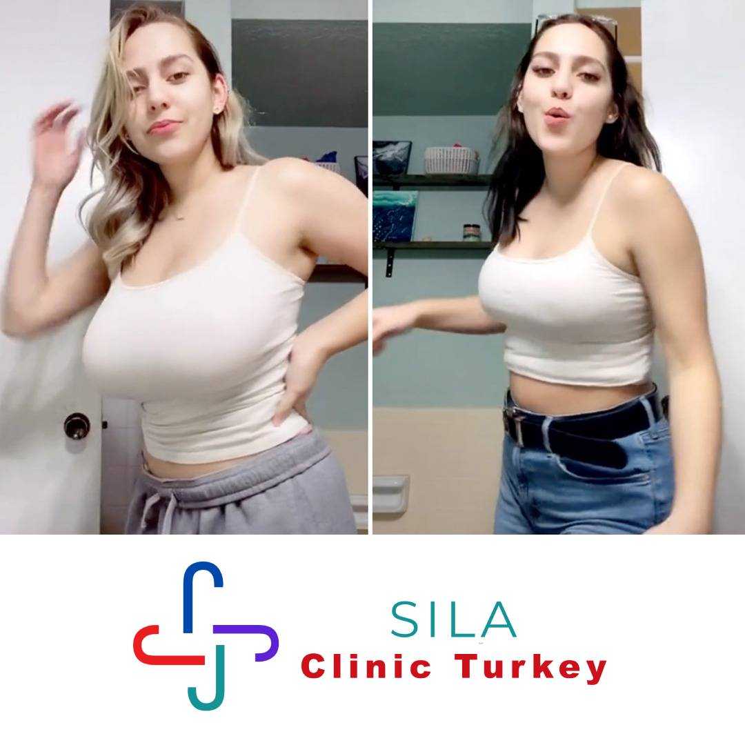 Meme Küçültme - Before After